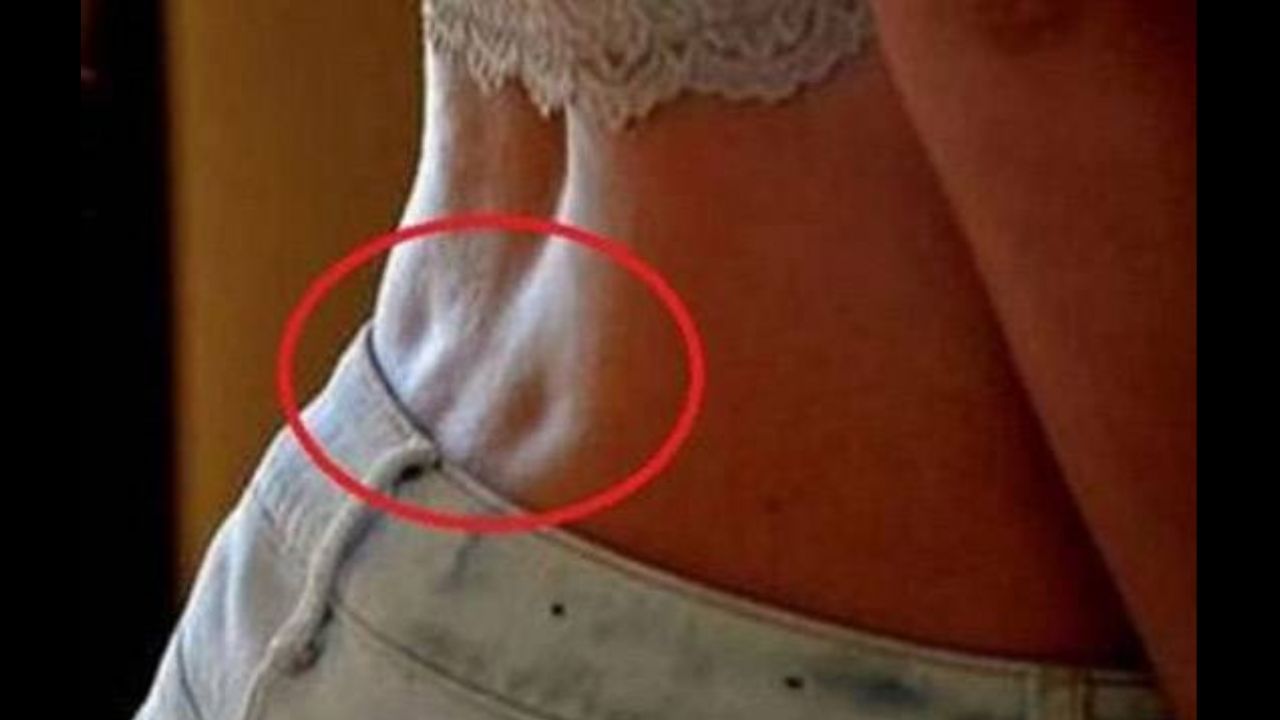 તે ડિમ્પલ પીઠ પર થવાનું કારણ શું છે તે જણાવીએ તો તે પેલ્વિસ અને ત્વચા વચ્ચેના લિગામેન્ટના કારણે થાય છે અને સ્વાસ્થ્ય પર તેની કોઈ ખરાબ અસર થતી નથી. એટલે કે તે કોઈ પણ રીતે શરીરને નુકસાન પહોંચાડતા નથી.