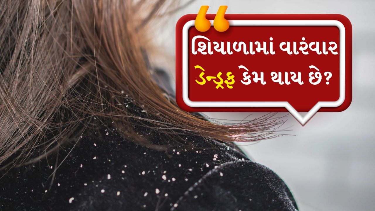 winter season Dandruff Problem