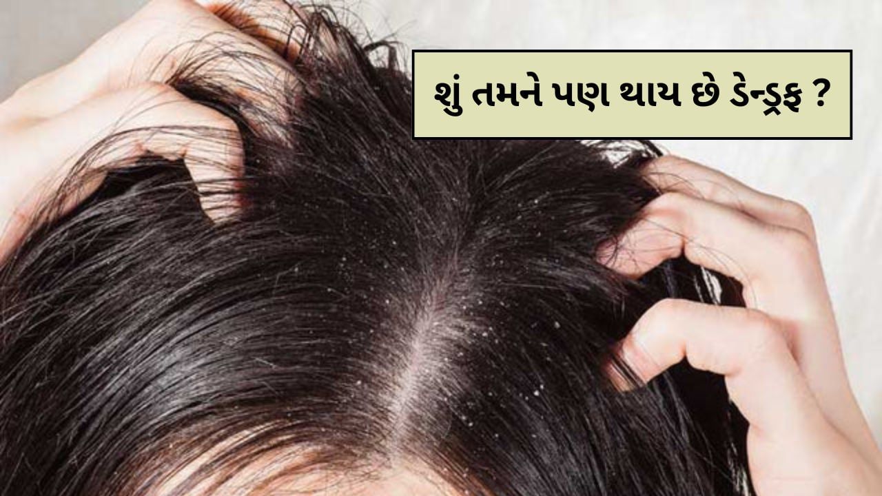 Hair problems : ડેન્ડ્રફથી છુટકારો મેળવવા માટે કરો ફટકડીનો ઉપયોગ, તરત મળશે રાહત