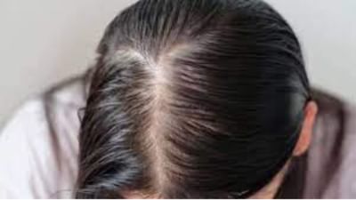 How To Black My White Hair:સફેદ વાળ હોવા ઘણા લોકો માટે શરમનું કારણ બની શકે છે. ઉંમરની સાથે વાળ સફેદ થવા સામાન્ય વાત છે, પરંતુ યુવાનીમાં સફેદ વાળ વ્યક્તિને શરમ અનુભવે છે અને વ્યક્તિના આત્મસન્માન અને આત્મવિશ્વાસને પણ અસર કરી શકે છે. સફેદ વાળને કાળા કરવા માટે બજારમાં ઘણી એવી પ્રોડક્ટ્સ છે જે દાવો કરે છે કે તેઓ સરળતાથી વાળને કાળા કરી શકે છે, પરંતુ તેમના પર વિશ્વાસ કરવો કેટલો યોગ્ય છે? આપણે બધા આપણા વાળને કુદરતી રીતે કાળા કરવા માંગીએ છીએ. આવી સ્થિતિમાં સફેદ વાળને કાળા કરવાના ઘરેલુ ઉપાયો છે જેને આપણે અપનાવવા જોઈએ. 