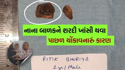 મધ્ય પ્રદેશના 1 વર્ષના બાળકને છેલ્લા 1 મહિનાથી શરદીની તકલીફ હોવાને કારણે તેને સારવાર માટે વડોદરા સયાજી હોસ્પિટલમાં લાવવામાં આવ્યો હતો. જ્યાં તબીબો દ્વારા તપાસ કરીને નિદાન કરાયું હતું કે, બાળકની અન્નનળીમાં છેલ્લા 30 દિવસથી સિંગોડાની છાલ ચોંટી ગઈ હતી. જેથી હોસ્પિટલમાં ડો.રંજન ઐયરની દેખરેખ હેઠળ બાળકની ઇસોફેગોસ્કોપી કરવામાં આવી હતી.