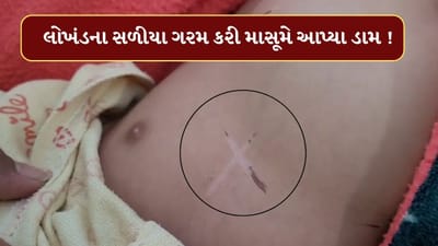 Dahod : લોખંડના ગરમ સળિયાથી 4 માસની માસૂમ બાળકીને આપ્યા ડામ ! ભૂવો થયો ફરાર, જુઓ Video Dahod : લોખંડના ગરમ સળિયાથી 4 માસની માસૂમ બાળકીને આપ્યા ડામ ! ભૂવો થયો ફરાર, જુઓ Video