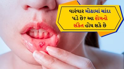 મોઢામાં ચાંદા એક સામાન્ય સમસ્યા છે. જેને લોકો ઘણીવાર ગંભીરતાથી લેતા નથી. આ સમસ્યા કોઈપણ ઉંમરે કોઈપણ વ્યક્તિને થઈ શકે છે. ફોલ્લા સામાન્ય રીતે મોંની અંદર, જીભ પર અથવા ગાલ, હોઠ અથવા ગળાની અંદરના ભાગમાં થાય છે. આ નાના ઘાવ હોય છે, જે ક્યારેક ખૂબ જ પીડાદાયક હોઈ શકે છે અને ખાવા-પીવામાં, બોલવામાં અથવા મોં હલાવવામાં પણ મુશ્કેલી ઊભી કરી શકે છે.