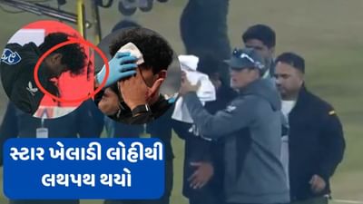 ચેમ્પિયન ટ્રોફી પહેલા ખેલાડીને આંખમાં બોલ વાગ્યો, સ્ટાર ખેલાડી લોહીથી લથપથ થયો જુઓ વીડિયો