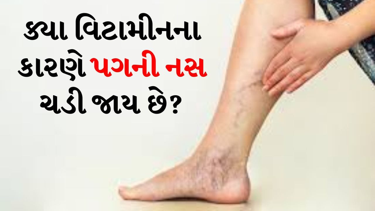 જો તમારી સાથે ક્યારેય એવું બન્યું હોય કે અચાનક તમારા પગની નસ ચડી જાય અને તમને તીવ્ર દુખાવો થવા લાગે, તો તમને ખબર પડશે કે તે કેટલું પીડાદાયક હોઈ શકે છે. ઘણા લોકો તેને ફક્ત થાક કે નબળાઈ સમજીને અવગણે છે પરંતુ વાસ્તવમાં તે કેટલાક આવશ્યક વિટામિન્સની ઉણપનું નિશાની હોઈ શકે છે.
