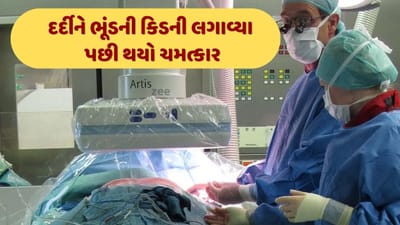 કિડની ડોનર ન મળ્યો, તો લગાવી દીધી ભૂંડની કિડની, પછી બની આશ્ચર્ય પમાડે તેવી ઘટના