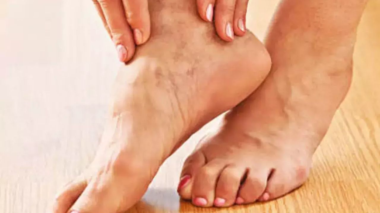 પાણીની અછતને કારણે નસો પણ ફૂલી શકે છે : જો શરીરમાં પાણીની ઉણપ હોય તો નસોમાં સોજો અને ખેંચાણની સમસ્યા વધી શકે છે. તેથી દિવસભરમાં ઓછામાં ઓછા 8-10 ગ્લાસ પાણી પીવો, જેથી નસો હાઇડ્રેટેડ રહે અને રક્ત પરિભ્રમણ યોગ્ય રહે.
