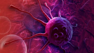 Cancer :ઘરમાં રાખેલી આ વસ્તુઓથી થાય છે કેન્સરનો ખતરો, તરત જ કરો દૂર, જાણો કેટલીક મહત્વની બાબતો