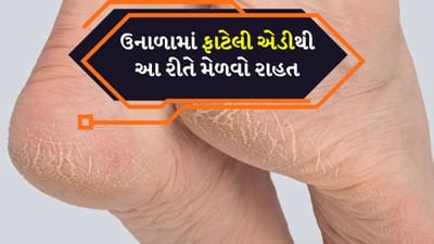 ઉનાળાની ઋતુ આવતાની સાથે જ આપણી ત્વચાને ખાસ કાળજીની જરૂર પડે છે. આ ઋતુમાં, મોટાભાગના લોકો પોતાના ચહેરા અને હાથની સંભાળ પર ધ્યાન આપે છે, પરંતુ ઘણીવાર પગની સંભાળને અવગણે છે. પરિણામે એડી ફાટી જાય છે. શિયાળામાં શુષ્ક ત્વચાને કારણે એડી ફાટી જાય છે પરંતુ જો ઉનાળામાં પણ તમારી એડી ફાટી રહી હોય તો તે ચિંતાનો વિષય બની શકે છે. ઉનાળામાં એડી ફાટવા પાછળ ઘણા કારણો હોઈ શકે છે. ઉદાહરણ તરીકે પગની ત્વચાની વધુ પડતી શુષ્કતા, પાણીની અછત, ધૂળ, વધુ પડતો પરસેવો અને ખોટા ફૂટવેર પહેરવા.