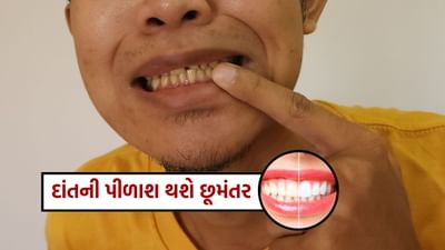 આજે, આ લેખમાં અમે તમને દાંતની અંદરની પીળાશને સાફ કરવા માટે કેટલાક ખૂબ જ અસરકારક ઘરેલું ઉપાયો જણાવીશું, જે તમને દાંતની પીળાશને દૂર કરવામાં મદદ કરશે.