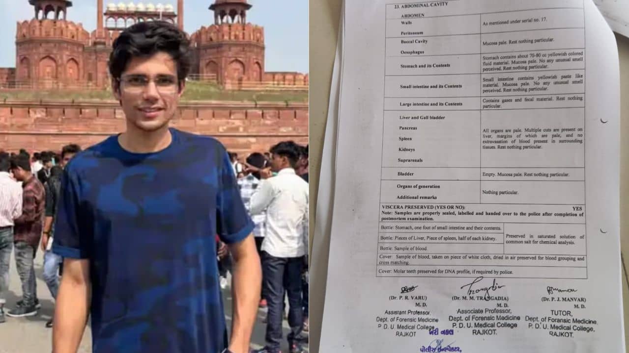 Breaking News : ગોંડલમાં રાજકુમાર જાટના મોત મામલે મોટો ખુલાસો, શરીર પર મારના નિશાન અને ગુદામાં 7 સેમી ઊંડો ચીરો