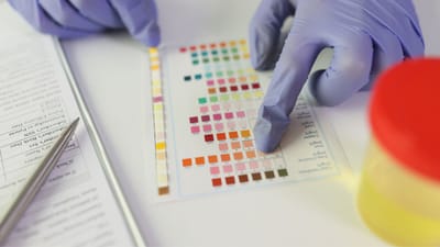 UTI શું છે? મૂત્રમાર્ગમાં સંક્રમણ ત્યારે થાય છે જ્યારે બેક્ટેરિયા (જંતુઓ) પેશાબની નળીઓમાં પ્રવેશ કરે છે. 