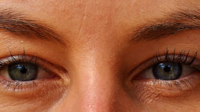 અતિશય ગરમી તમારા સ્વાસ્થ્ય તેમજ તમારી આંખના સ્વાસ્થ્યને અસર કરે છે. લાંબા સમય સુધી સંપર્કમાં રહેવાથી વારંવાર અલ્ટ્રાવાયોલેટ કિરણો વધે છે. જે આંખની ઘણી સમસ્યાઓનું કારણ બની શકે છે.