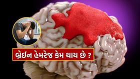 Brain Hemorrhage : બ્રેઈન હેમરેજ કયા કારણથી થાય છે? જાણી લો Brain Hemorrhage : બ્રેઈન હેમરેજ કયા કારણથી થાય છે? જાણી લો