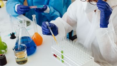  યૂરિનમાંથી દુર્ગંધ આવવી એક સામાન્ય સમસ્યા છે પરંતુ જ્યારે અચાનક યૂરિનમાં વધારે દુર્ગંધ આવવા લાગે તો નજરઅંદાજ કરવું જોઈએ નહી. સામાન્ય રીતે આને આપણે ઓછી પાણી પીવા સાથે જોડી દઈએ છીએ પરંતુ કેટલીક વખત આ બીમારીનો પણ સંકેત હોય શકે છે.તો ચાલો જાણીએ કે,યૂરિનમાંથી દુર્ગંધ કેમ આવે છે. આની પાછળ કઈ બીમારીઓ હોય શકે. આની સારવાર શું છે.