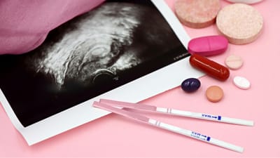 જ્યારે કોઈ મહિલા પ્રેગ્નેન્ટ થાય છે. તો શરીરમાં કેટલાક બદલાવ જોવા મળે છે. કેટલીક મહિલાઓને પ્રેગ્નેન્સી દરમિયાન ફાઈબ્રોઈડસ એટલે કે, રસોલીની સમસ્યા થઈ શકે છે.આ એક પ્રકારની નોન-કેન્સરની ગાંઠ હોય છે. જે ગર્ભાશય  (uterus)માં બને છે.