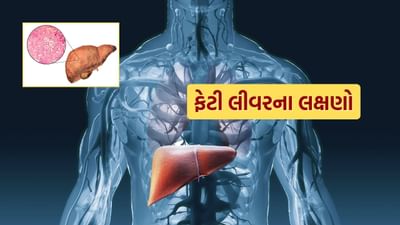 ફેટી લીવરના બે મુખ્ય લક્ષણો છે. પ્રથમ, પેટના જમણા ઉપરના ભાગમાં દુખાવો અથવા અસ્વસ્થતા અને બીજું, થાક અથવા નબળાઈની લાગવી.