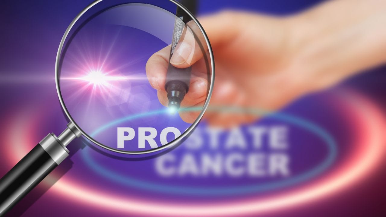 Men’s Problem : પુરુષોમાં પ્રોસ્ટેટ કેન્સરનું કારણ બને છે આ 6 ખરાબ આદત, જાણી લો