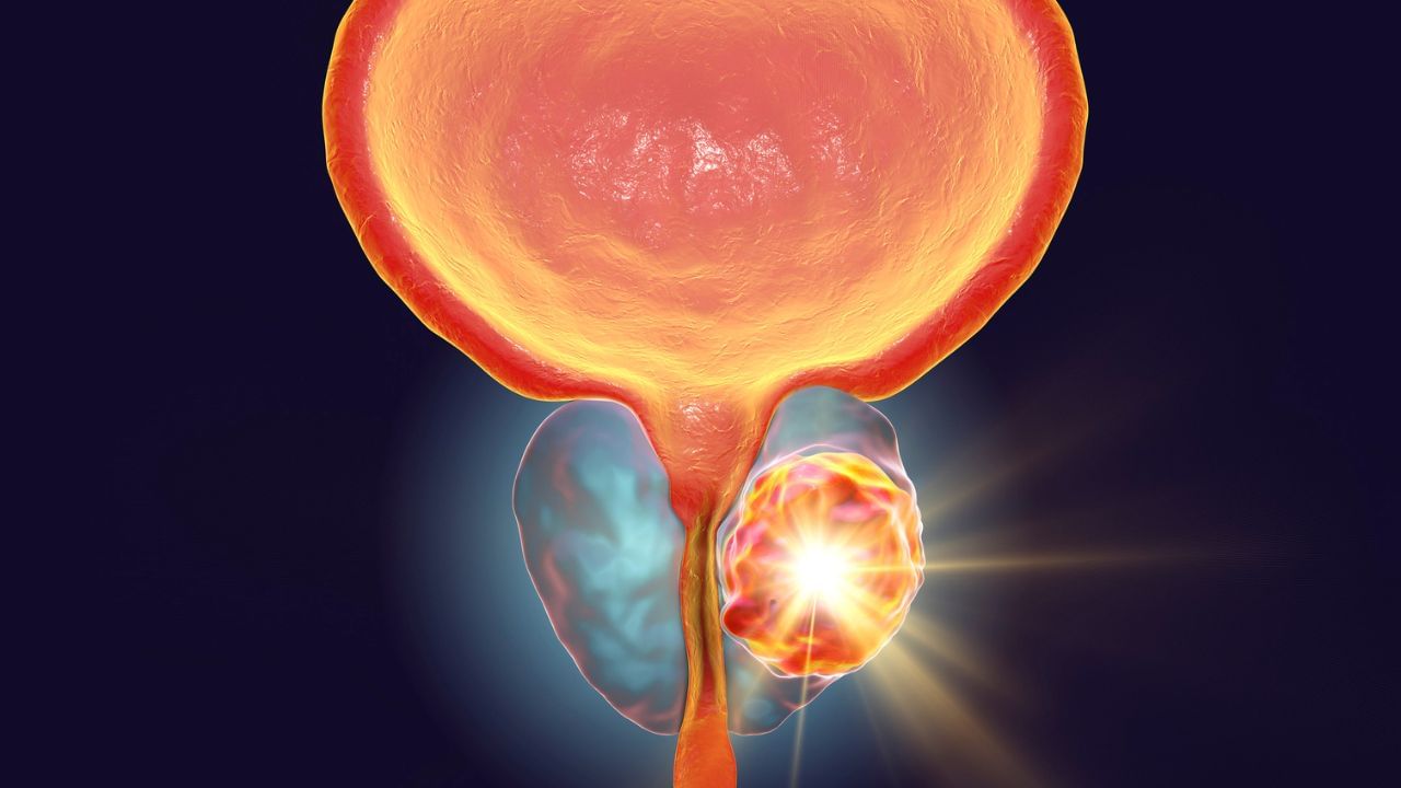 Cancer Symptoms : તમને વારંવાર પેશાબ લાગે છે.. તો આ કેન્સરનું હોઈ શકે લક્ષણ ! જાણી લો