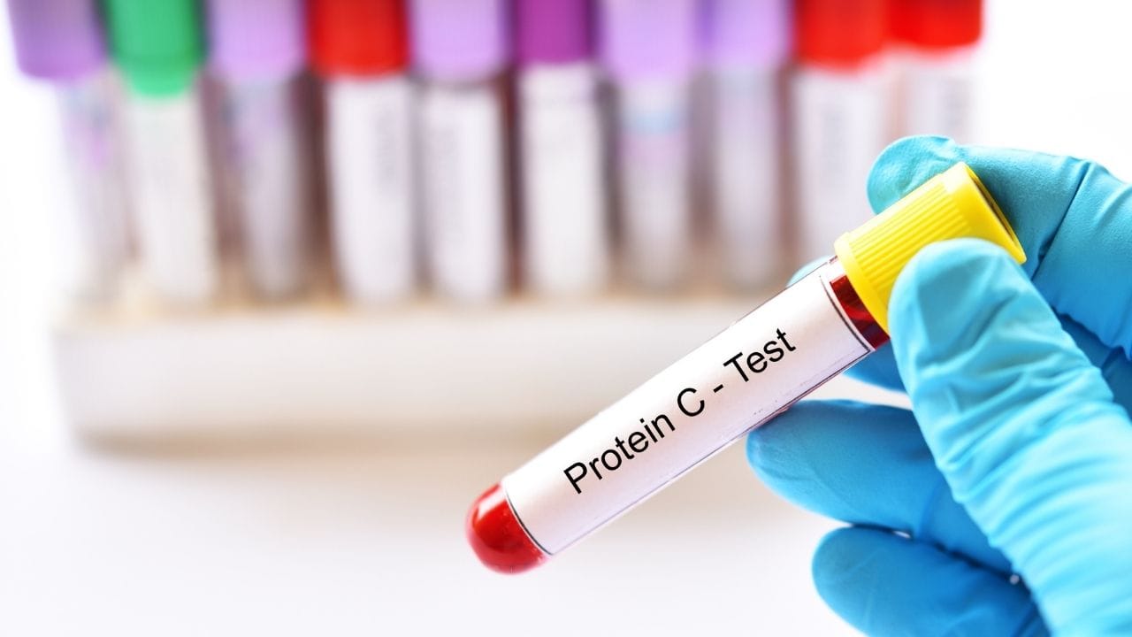 લગભગ 90 અલગ અલગ પ્રોટીન માપવામાં આવ્યા. ઓછી ઊંઘ લીધા પછી રક્તમાં અસ્વસ્થ ફુલાવાવાળા પ્રોટીન વધ્યા. સામાન્ય રીતે કસરત હૃદય માટે સારા એવા ઈન્ટરલ્યુકીન-6 અને BDNF જેવી પ્રોટીન વધારતી હોય છે, પણ ઊંઘના અભાવે તેમાં ઘટાડો થયો. સૌથી ચિંતાજનક વાત એ હતી કે, યુવાન સ્વસ્થ વ્યસ્કોમાં પણ આ નકારાત્મક અસર જોવા મળી.