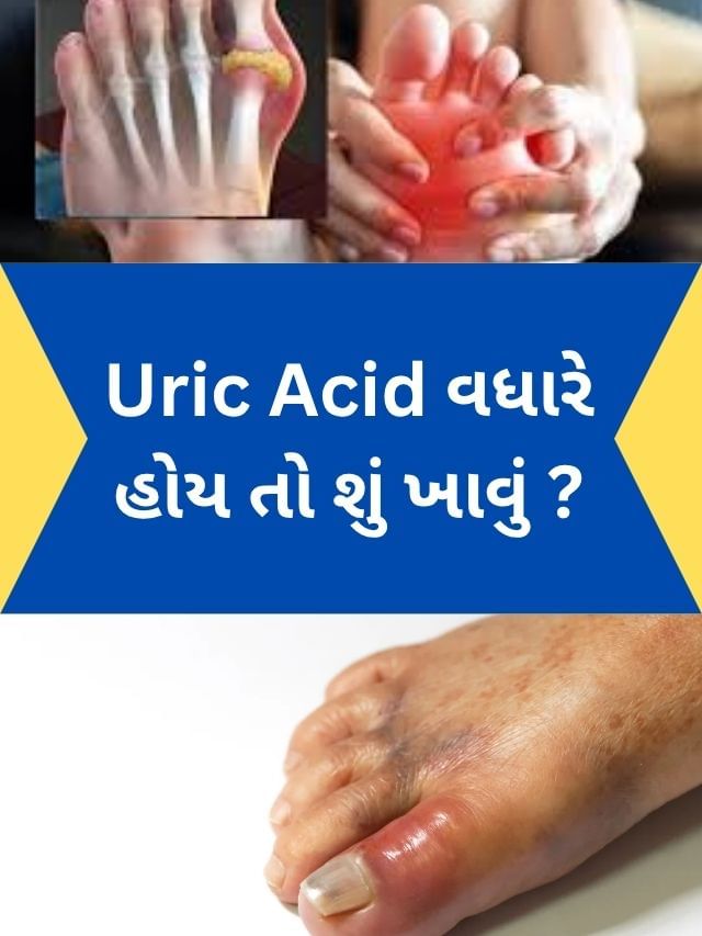Uric Acid વધે ત્યારે ખાલી પેટ શું ખાવું? Uric Acid વધે ત્યારે ખાલી પેટ શું ખાવું?