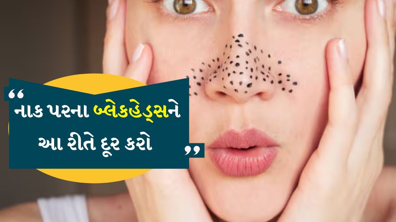 ચહેરા પર નાકની આસપાસ બ્લેકહેડ્સ દેખાય છે. જેને કીલ પણ કહેવામાં આવે છે. આને કારણે ત્વચા ખરબચડી અને દાણાદાર દેખાવા લાગે છે. લોકો તેને દૂર કરવા માટે સ્ક્રબ કરે છે અને ઘણા પ્રયત્નો કરે છે. પરંતુ આ પછી પણ આ હઠીલા બ્લેકહેડ્સ સરળતાથી ઓછા થતા નથી. આને કારણે ચહેરો નિસ્તેજ દેખાવા લાગે છે. તેથી તેને ઘટાડવા માટે ઘણી વસ્તુઓ મદદરૂપ થઈ શકે છે.
