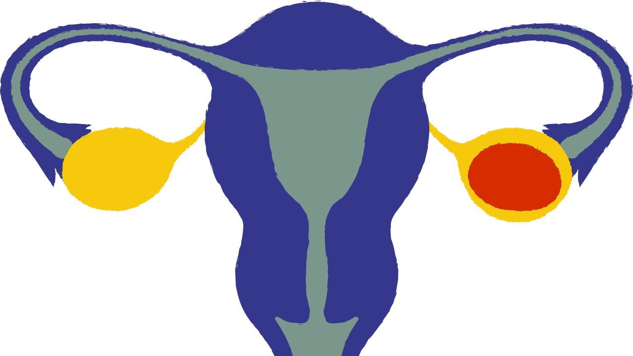 નોંધ : અહીં આપવામાં આવેલી માહિતી ફક્ત આપની જાણકારી માટે છે. કોઈ પણ ઈલાજ કરતાં પહેલા કે,અમલમાં લેતા પહેલા નિષ્ણાતોની સલાહ લેવી જરુરી છે. ( all photo:canva)