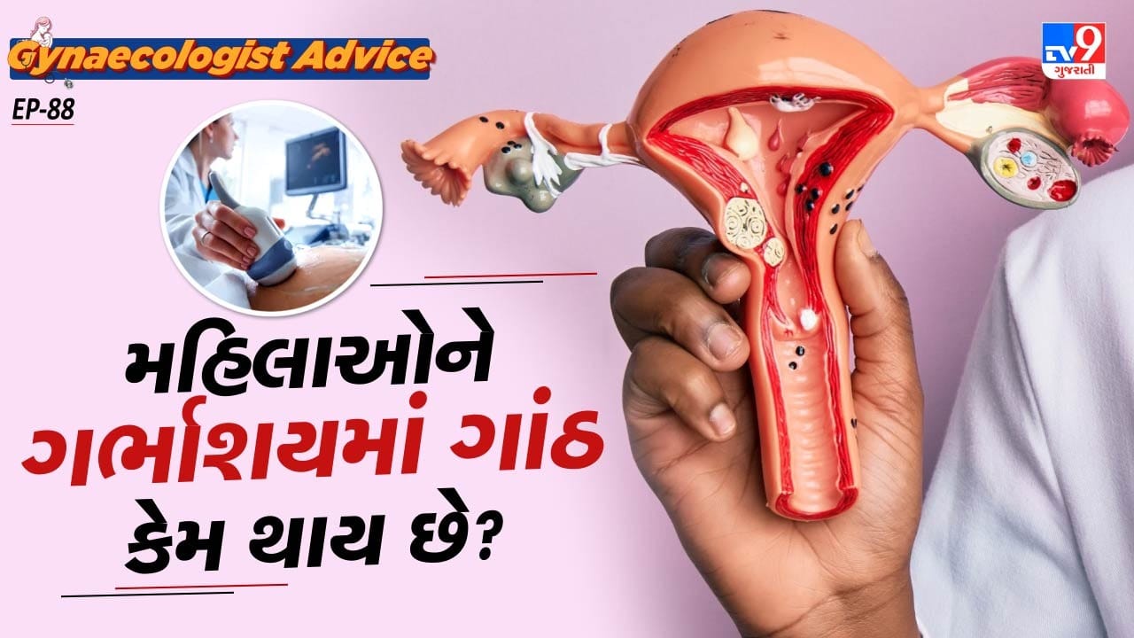 ભાગદોડ ભરી લાઈફસ્ટાઈલ અને સ્વાસ્થ્યનું ધ્યાન  ન રાખવાના કારણે મહિલાઓના શરીરમાં એસ્ટ્રોજન અને પ્રોજેસ્ટેટેરોન જેવા હોર્મોન્સને અસંતુલિત થવાની સમસ્યા થવા લાગે છે. જેના કારણે ફાઇબ્રોઇડ્સની સમસ્યા એક સામાન્ય કારણ છે.