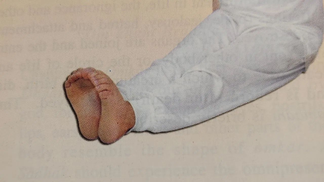 અંગૂઠાના દુખાવામાં રાહત મેળવવા માટે કસરત : જો અંગૂઠામાં જડતા અને દુખાવો હોય, તો આ કસરત સરળ અને અસરકારક પણ છે. દંડાસનમાં બેસીને, એડી સીધી રાખો અને અંગૂઠાને જોડો. આ પછી, ધીમે ધીમે આંગળીઓને સંપૂર્ણ તાકાતથી આગળ વાળો અને પછી તેમને પાછળ લાવો. આ રીતે આઠથી દસ વખત આ કસરત કરો.