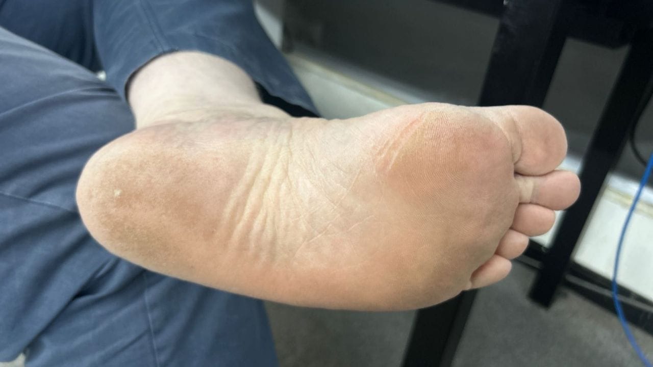 જે વ્યક્તિના તળિયા કાળા હોય છે તેને પોતાના જીવનમાં ઘણી સમસ્યાઓનો સામનો કરવો પડે છે. આવા લોકો હંમેશા કોઈ અજાણ્યા ભયથી ઘેરાયેલા રહે છે. સ્વાસ્થ્યની બાબતમાં પણ તેમનું નસીબ તેમનો સાથ આપતું નથી. સ્વાસ્થ્ય સંબંધિત કોઈને કોઈ સમસ્યા તેમનો પીછો કરતી રહે છે. ઉપરાંત, આ લોકો પૈસાના અભાવે પરેશાન રહે છે. સંતાન સુખનો અભાવ પણ તેમની મુશ્કેલીઓનું એક મોટું કારણ છે.