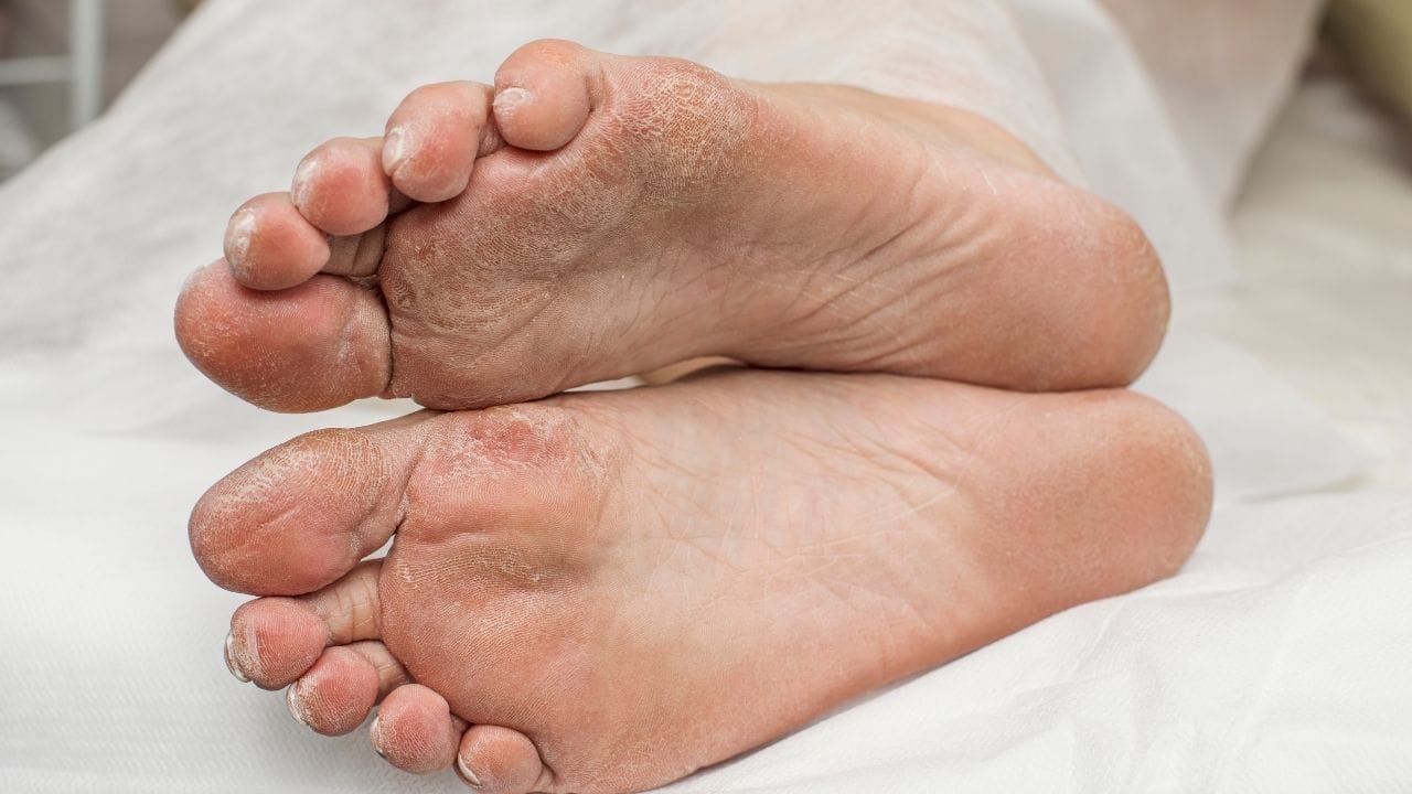 સામુદ્રિક શાસ્ત્ર અનુસાર, ગુલાબી રંગના તળિયાવાળા લોકો પ્રેમની બાબતમાં હંમેશા બીજા કરતા બે પગલાં આગળ હોય છે. આ લોકો પોતાના પ્રેમી કે પતિ કે પત્નીને કેવી રીતે ખુશ રાખવા તે ખૂબ સારી રીતે જાણે છે. કારણ કે તેઓ પોતાની પસંદ અને નાપસંદથી સારી રીતે વાકેફ હોય છે. આ રંગના તળિયાવાળા લોકો બીજાઓને ખૂબ જ ઝડપથી પોતાની તરફ આકર્ષિત કરે છે અને ખાસ વાત એ છે કે અન્ય લોકો પણ તેમના વ્યક્તિત્વથી પ્રભાવિત થાય છે. આ રંગ સારા પરિણામો આપનાર માનવામાં આવે છે. તે વ્યક્તિના જીવનમાં સુખ અને સમૃદ્ધિ બંને લાવે છે. (નોંધ : અહીં આપવામાં આવેલી માહિતી શસ્ત્રોના આધારે ફક્ત આપની જાણકરી માટે છે.)