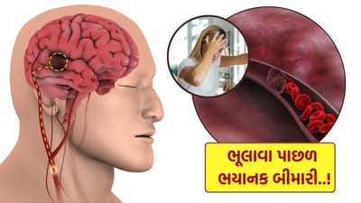 અલ્ઝાઇમરનું ચોક્કસ કારણ હજુ સુધી સ્પષ્ટ નથી, પરંતુ એવું માનવામાં આવે છે કે મગજમાં અસામાન્ય પ્રોટીન જમા થવું, આનુવંશિક પરિબળો, વધતી ઉંમર અને ખરાબ જીવનશૈલીને લગતા પરિબળો આનું કારણ હોઈ શકે છે. ચાલો જાણીએ તેના લક્ષણો.