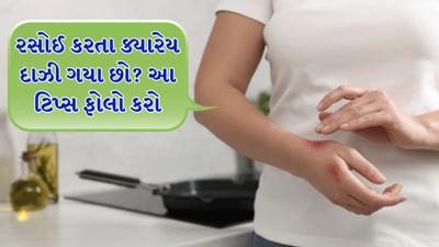 ઘણી વખત રસોડામાં ઉતાવળમાં કામ કરતી વખતે ગરમ તેલ, વરાળ, આગ અથવા કોઈપણ વાસણથી આપણા હાથ બળી જાય છે. આ બળતરા સહન કરવી ખૂબ જ મુશ્કેલ છે. આવી સ્થિતિમાં, લોકોને સમજાતું નથી કે બળી જાય તો તાત્કાલિક શું કરવું અથવા અસરગ્રસ્ત વિસ્તાર પર શું લગાવવું? ઘણી વખત નાના તેલના છાંટા જાતે જ મટી જાય છે. પરંતુ ક્યારેક હાથ વધુ બળી જાય છે.