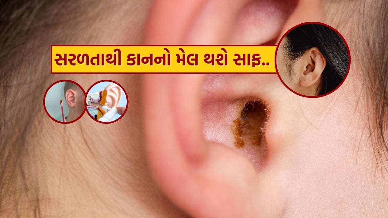 કાનની અંદર જમા થતો મેલ સેરેમિન (Cerumen) કહેવાય છે. આ મેલ વિવિધ કારણોથી કાનમાં જામી શકે છે અને આથી વિવિધ તકલીફો ઊભી થઈ શકે છે. સમયસર કાનને સાફ કરવું ખૂબ જ અગત્યનું છે. ઘણા લોકો વિવિધ ઉપાયો અજમાવે છે, પણ ખોટી રીતથી કાઢેલા મેલ કાનને નુકસાન પહોંચાડી શકે છે.