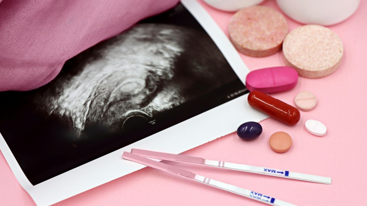 IVF પ્રક્રિયામાં શું થાય છે?IVF એટલે વિટ્રો ફર્ટિલાઈઝેશન એક એવી ટેકનીક છે. જેમાં મહિલાના એગ અને પુરુષના સ્પર્મને શરીરની બહાર લેબમાં મેળવવામાં આવે છે.જેનાથી ભ્રુણ બની શકે. જ્યારે ભ્રુણ તૈયાર થઈ જાય છે. તો આ મહિલાના ગર્ભાશયમાં નાંખવામાં આવે છે. જેનાથી તે વિકસિત થઈ શકે અને પ્રેગ્નન્સી શરુ થાય.