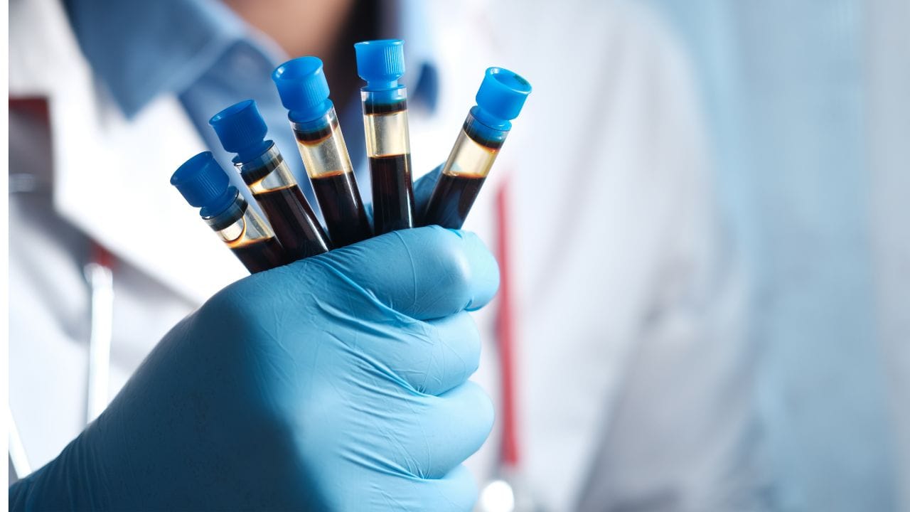 Complete Blood Count (CBC)થી એનીમિયા કે ઈન્ફેક્શનની જાણ થાય છે. આ સાથે વિટામિન ડી અને બી12ની ઉણપ 35 બાદ સામાન્ય થઈ જાય છે. જેનાથી હાંડકામાં દુખાવો થાક,માનસિક થાક લાગે છે.