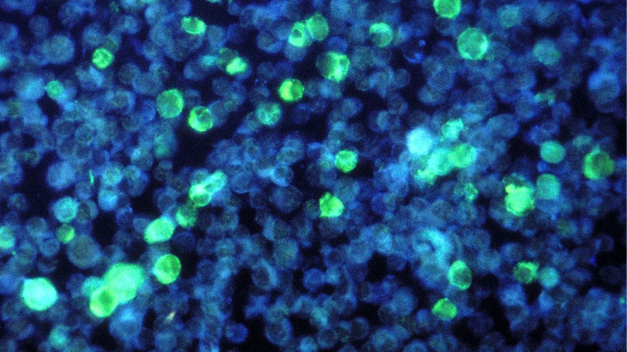 શું ફાઇબ્રોઇડ્સથી પ્રેગ્નન્સી શક્ય છે? આ પ્રશ્નનો જવાબ આપતાં, ડૉક્ટર કહે છે કે જો પ્રેગ્નન્સીમાં ગાંઠનું કદ નાનું હોય અને તેની યોગ્ય સમયે સારવાર કરવામાં આવે, તો પ્રેગ્નન્સી સંપૂર્ણપણે શક્ય છે.