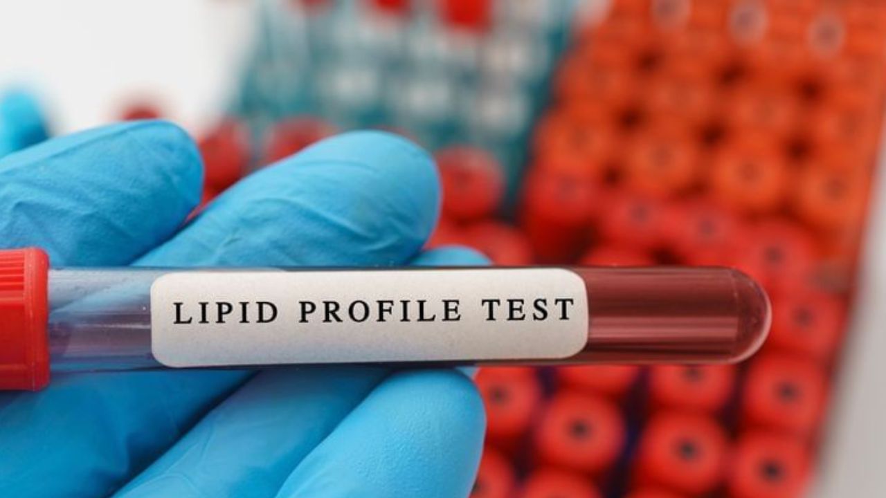 લિપિડ પ્રોફાઇલ - આ પરીક્ષણમાં, કોલેસ્ટ્રોલ અને ટ્રાઇગ્લિસેરાઇડનું પ્રમાણ માપવામાં આવે છે. જો આ વધારે હોય, તો અવરોધનું જોખમ પણ વધારે છે. આનાથી ડૉક્ટરને ખબર પડે છે કે વધુ પરીક્ષણોની જરૂર છે કે નહીં. લિપિડ પ્રોફાઇલ ટેસ્ટ આ સૌથી સચોટ ટેસ્ટ છે.