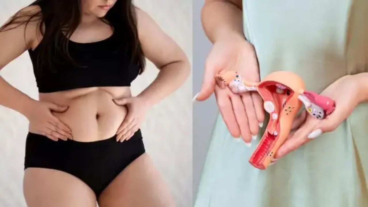 વર્લ્ડ હેલ્થ ઓર્ગેનાઈઝેશનના જણાવ્યા અનુસાર  PCOS સામાન્ય રીતે કિશોરાવસ્થામાં શરૂ થાય છે અને હોર્મોન અસંતુલન, ઈરેગ્યુલર પીરિયડ્સ, એન્ડ્રોજન (મેલ હોર્મોન)નું વધુ પડતુ સ્તર અને ઓવરીમાં સિસ્ટ (ગાંઠો) બનવાને કારણે થાય છે. આ ઉપરાંત તેનાથી પીડિત મહિલાઓમાં વજન વધવાની સંભાવના વધુ હોય છે. 