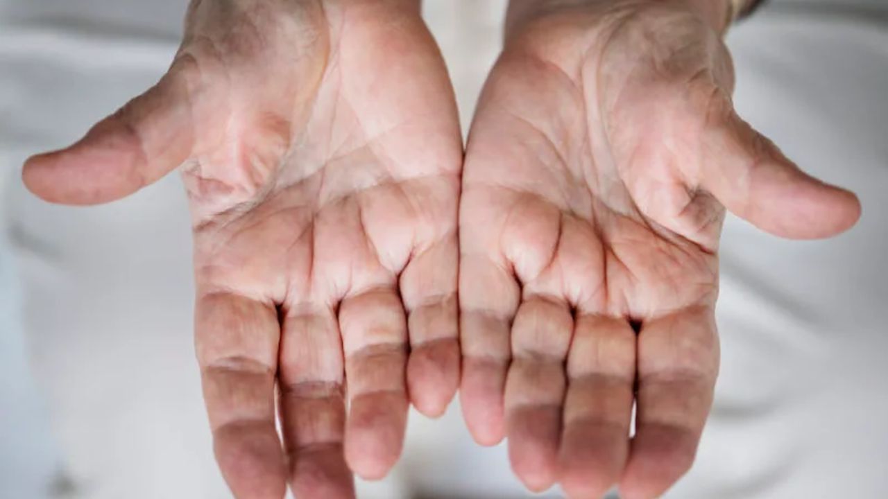 નરમ અને કઠણ હથેળીવાળા લોકો: જે લોકોની હથેળી નરમ હોય છે એટલે કે હથેળી પર વધુ માંસ હોય છે અને આખી હથેળી નરમ હોય છે તેમને જીવનમાં વધુ ખુશી મળે છે. આવા લોકો રોમેન્ટિક હોય છે અને તેમની વાત કરવાની કળા અન્ય લોકો કરતા અલગ હોય છે. આ ઉપરાંત લોકો પહેલી જ મુલાકાતમાં તેમના દિવાના થઈ જાય છે. જ્યારે કઠણ હથેળીવાળા લોકોને ખુશી મેળવવા માટે ખૂબ જ મહેનત કરવી પડે છે. તેઓ ફક્ત તેમની મહેનત દ્વારા જ નામ કમાય છે. પરંતુ તેમનામાં કંઈક કરવાનો જુસ્સો હોય છે.
