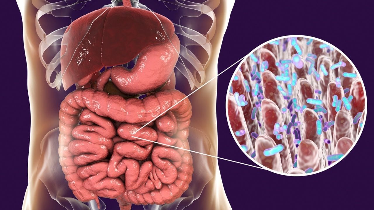 Understanding Flatulence Your Gut's Secret Messages (5)