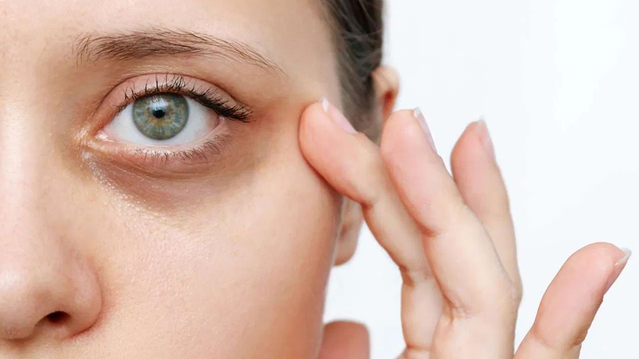 આ ટિપ્સ પણ ઉપયોગી થઈ શકે છે - ડાર્ક સર્કલ ઘટાડવા માટે, બટાકાનો રસ આંખો નીચે 10 થી 15 મિનિટ માટે લગાવી શકાય છે. હળદરની પેસ્ટ પણ ડાર્ક સર્કલ ઘટાડવામાં અસરકારક છે. કાકડીનો રસ અથવા કાકડીના ટુકડા પણ આંખો નીચે લગાવી શકાય છે. તેમજ તમારે આંખોને ઘસીને સાફ ન કરવી જોઈએ. રાત્રે સૂતા પહેલા નાળિયેર તેલ લગાવવું પણ ફાયદાકારક થઈ શકે છે.