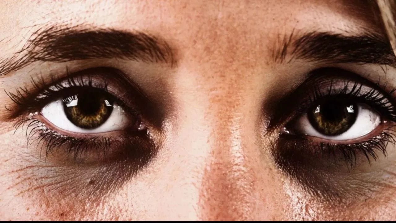 આંખો નીચે ડાર્ક સર્કલ ખૂબ જ સામાન્ય છે. ઊંઘનો અભાવ, ખાવામાં બેદરકારી, તણાવ, વૃદ્ધત્વ, ડિહાઇડ્રેશન અથવા સ્ક્રીન પર વધુ સમય વિતાવવાથી પણ ડાર્ક સર્કલ આવે છે. આંખો નીચે અને કુંડાળાએ વૃદ્ધત્વની નિશાની પણ માનવામાં આવે છે, પરંતુ આજના સમયમાં, યુવાનોમાં પણ કુંડાળા પડવાની સમસ્યા જોવા મળે છે. કિશોરાવસ્થાના બાળકોમાં પણ ડાર્ક સર્કલ થવાની સમસ્યા હોય છે. ઘણા લોકોમાં ડાર્ક સર્કલની સમસ્યા આનુવંશિક હોઈ શકે છે, તેથી તેને સંપૂર્ણપણે અટકાવવી થોડી મુશ્કેલ છે. આવા લોકોએ તેમની દિનચર્યા અને ત્વચાની સંભાળ પર વધુ ધ્યાન આપવું જોઈએ. 