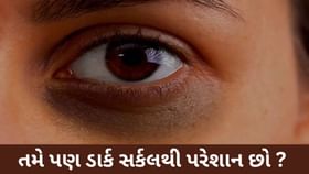 ડાર્ક સર્કલ : માત્ર સુંદરતા જ નહીં, સ્વાસ્થ્યનો પણ સંકેત ! ડાર્ક સર્કલ : માત્ર સુંદરતા જ નહીં, સ્વાસ્થ્યનો પણ સંકેત !
