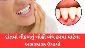 પેઢામાંથી લોહી નીકળતું હોય તો શું કરવું? પેઢામાંથી લોહી નીકળતું હોય તો શું કરવું?