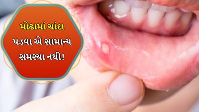 Frequent Mouth Ulcers: મોઢામાં ચાંદા પડવા એ એક સામાન્ય સમસ્યા છે. ક્યારેક તે આહારની અનિયમિતતા, મસાલેદાર ખોરાક અથવા ગરમીને કારણે થાય છે. પરંતુ જ્યારે આ ચાંદા વારંવાર અને કોઈ દેખીતા કારણ વગર થવા લાગે છે, ત્યારે તેને હળવાશથી ન લેવું જોઈએ. વારંવાર મોંમાં ચાંદા પડવા એ ફક્ત એસિડિટી અથવા વિટામિનની ઉણપનું લક્ષણ નથી, પરંતુ તે તમારી રોગપ્રતિકારક શક્તિમાં ખામી અથવા પાચનતંત્રમાં મોટી સમસ્યાનું પણ સંકેત હોઈ શકે છે.
