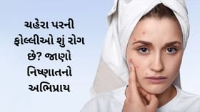 શું ચહેરા પર ફોલ્લીઓ એક રોગ છે? જાણો નિષ્ણાતનો અભિપ્રાય શું ચહેરા પર ફોલ્લીઓ એક રોગ છે? જાણો નિષ્ણાતનો અભિપ્રાય