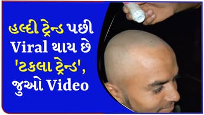 હળદરનું ભૂત ઉતર્યું, તો હવે ટકલા ટ્રેન્ડ એ ધમાલ મચાવી, 9 કરોડ લોકોએ જોયો આ Video