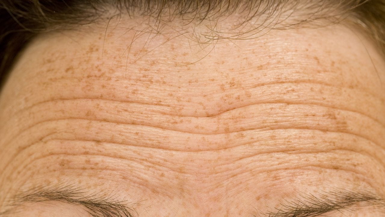 સપાટ કપાળ: સપાટ કપાળ સૂચવે છે કે વ્યક્તિ સ્વભાવે શાંત, સંતુલિત અને જવાબદાર છે. આવા લોકો વર્તનમાં નમ્ર હોય છે અને મુશ્કેલ પરિસ્થિતિઓમાં પણ સ્થિરતા જાળવી રાખે છે.
