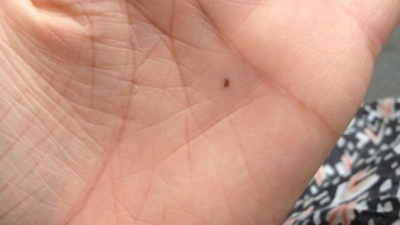 આ તલ પણ શુભ છે: જો કોઈ વ્યક્તિની અનામિકા આંગળી પાસે અથવા હથેળીની વચ્ચે તલ હોય તો તેને સમુદ્ર શાસ્ત્રમાં ખૂબ જ શુભ સંકેત માનવામાં આવે છે. આનો અર્થ એ છે કે ભવિષ્યમાં તમારે પૈસા સંબંધિત સમસ્યાઓનો સામનો કરવો પડશે નહીં. આ સાથે જો કોઈ વ્યક્તિના કપાળની જમણી બાજુ તલ હોય, તો તે સૂચવે છે કે તેને જીવનમાં ક્યારેય પૈસાની સમસ્યાઓનો સામનો કરવો પડશે નહીં.
